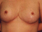 Patient # 74660 After Photo # 2