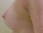 Patient # 78952 After Photo # 4