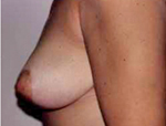 Patient # 25406 After Photo # 4