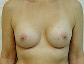 Patient # 41405 After Photo # 2