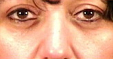Patient # 81999 After Photo # 2