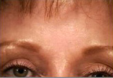Patient # 29476 After Photo # 2