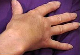 Patient # 59056 After Photo # 2
