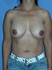 Patient # 58803 After Photo # 2