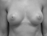 Patient # 68803 After Photo # 2