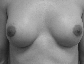 Patient # 36398 After Photo # 2