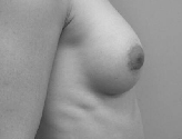 Patient # 36398 After Photo # 4