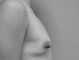 Patient # 36398 Before Photo # 3