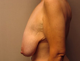 Patient # 32727 Before Photo # 5