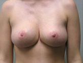 Patient # 34883 After Photo # 2