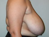 Patient # 37235 Before Photo # 5