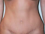Patient # 23281 After Photo # 2