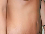 Patient # 23281 After Photo # 4