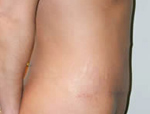 Patient # 23281 After Photo # 6