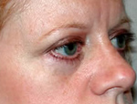 Patient # 49266 After Photo # 4