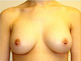 Patient # 40232 After Photo # 2