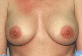 Patient # 61976 After Photo # 2