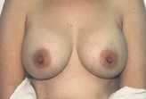Patient # 15078 After Photo # 2
