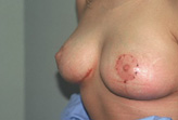 Patient # 44479 After Photo # 4