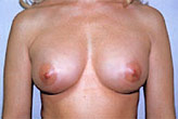 Patient # 18510 After Photo # 2