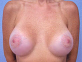 Patient # 29499 After Photo # 2