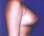 Patient # 41619 After Photo # 2