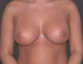 Patient # 27713 After Photo # 2