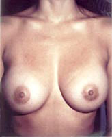 Patient # 25609 After Photo # 2