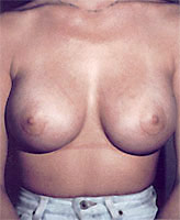 Patient # 20860 After Photo # 2