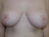 Patient # 37131 After Photo # 2