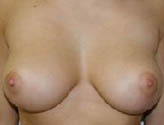 Patient # 25623 After Photo # 2