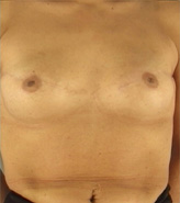 Patient # 35268 After Photo # 2