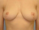 Patient # 65196 After Photo # 2
