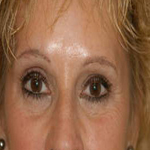 Patient # 23356 After Photo # 2