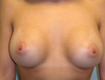 Patient # 25626 After Photo # 2