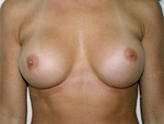 Patient # 50978 After Photo # 2