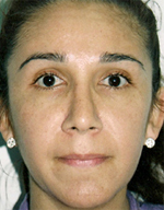 Patient # 30963 After Photo # 2