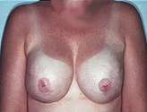 Patient # 54366 After Photo # 2
