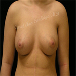 Patient # 78340 After Photo # 2