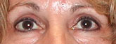 Patient # 49558 After Photo # 2