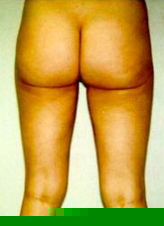 Patient # 43624 After Photo # 4