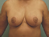 Patient # 59832 After Photo # 2