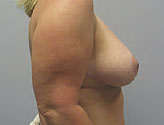 Patient # 59832 After Photo # 4