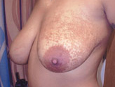 Patient # 83235 Before Photo # 3
