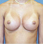 Patient # 27314 After Photo # 2