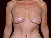 Patient # 66959 After Photo # 2