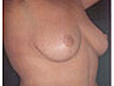Patient # 67667 After Photo # 2