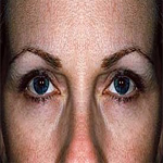 Patient # 63677 After Photo # 2