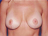 Patient # 63572 After Photo # 2