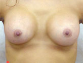 Patient # 15937 After Photo # 2